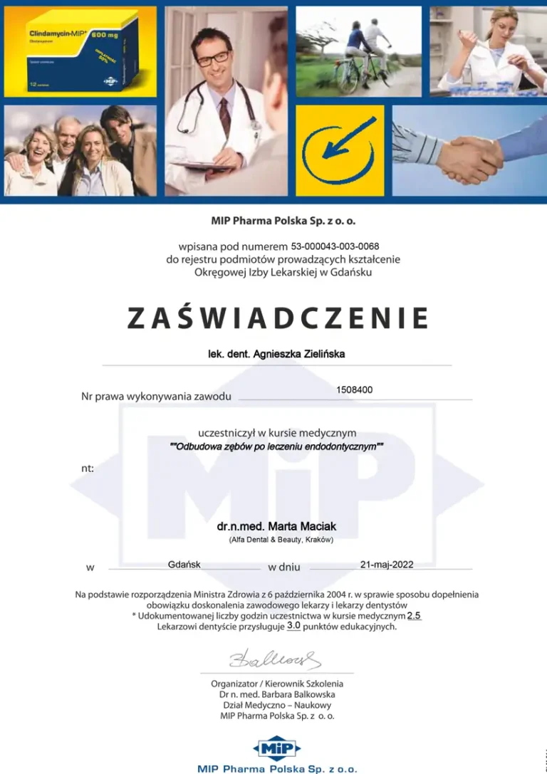 Odbudowa zębów po leczeniu endodontycznym